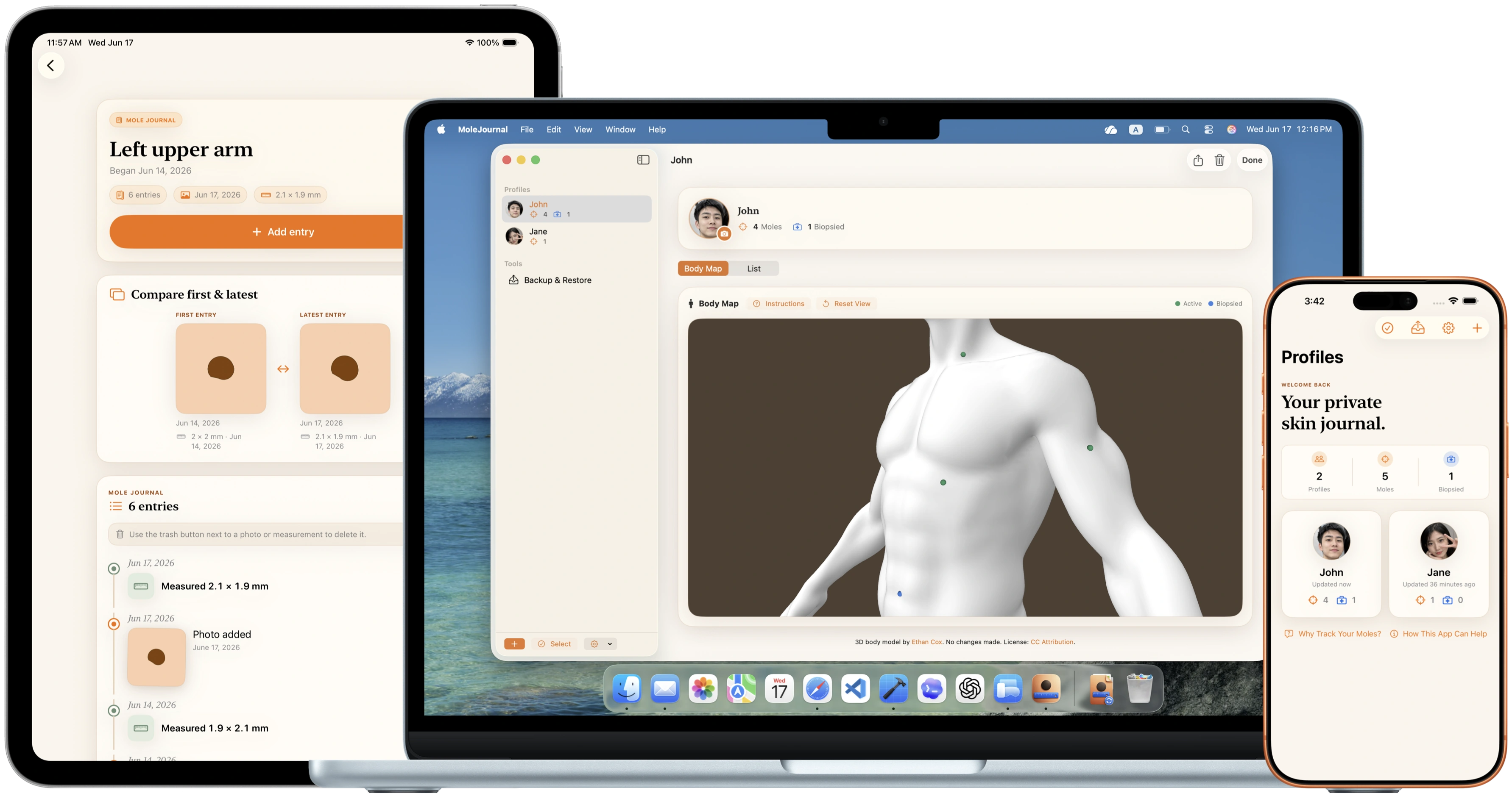MoleJournal shown on MacBook Pro, iPad Pro, and iPhone