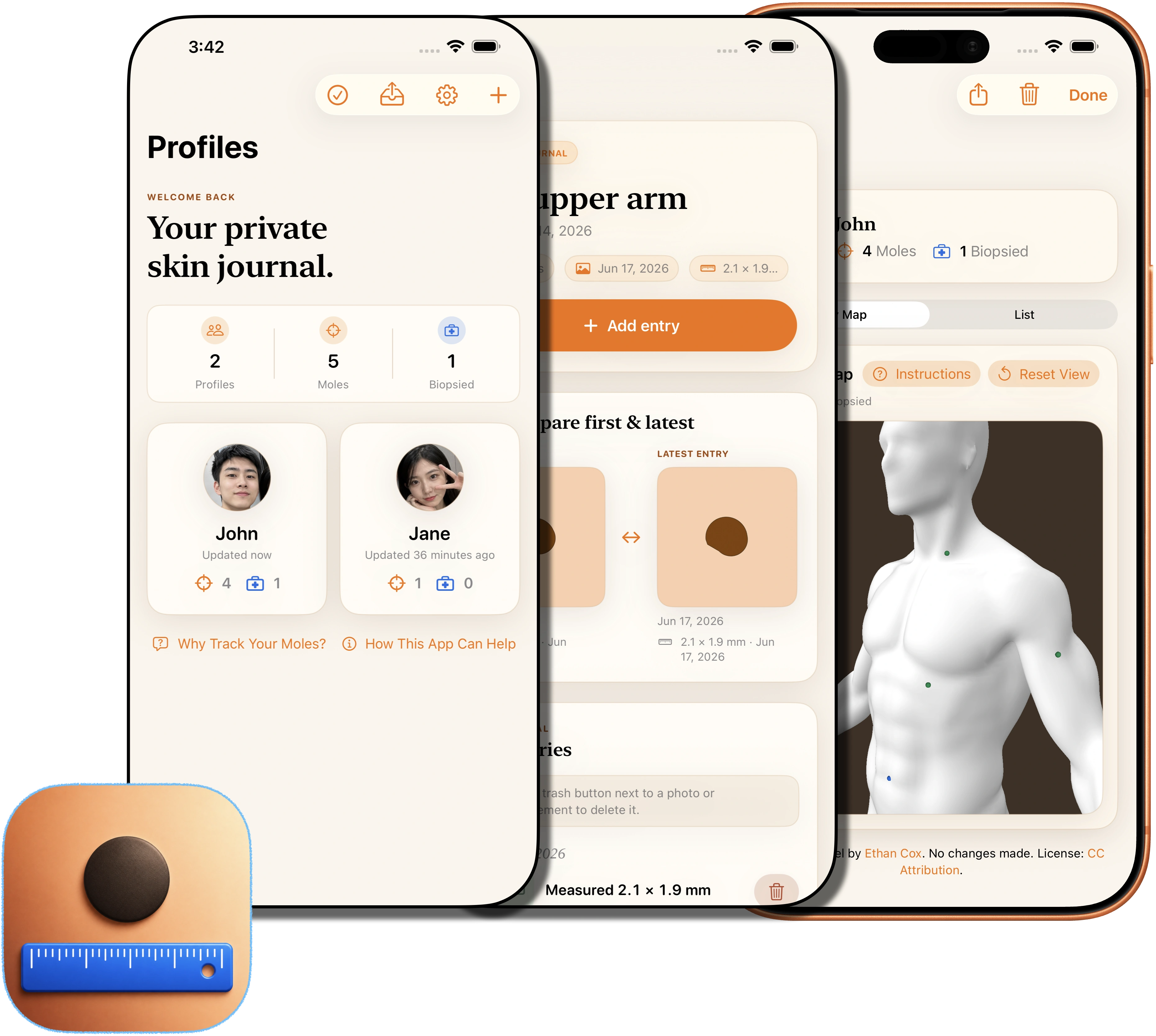 MoleJournal app screens shown across Apple devices
