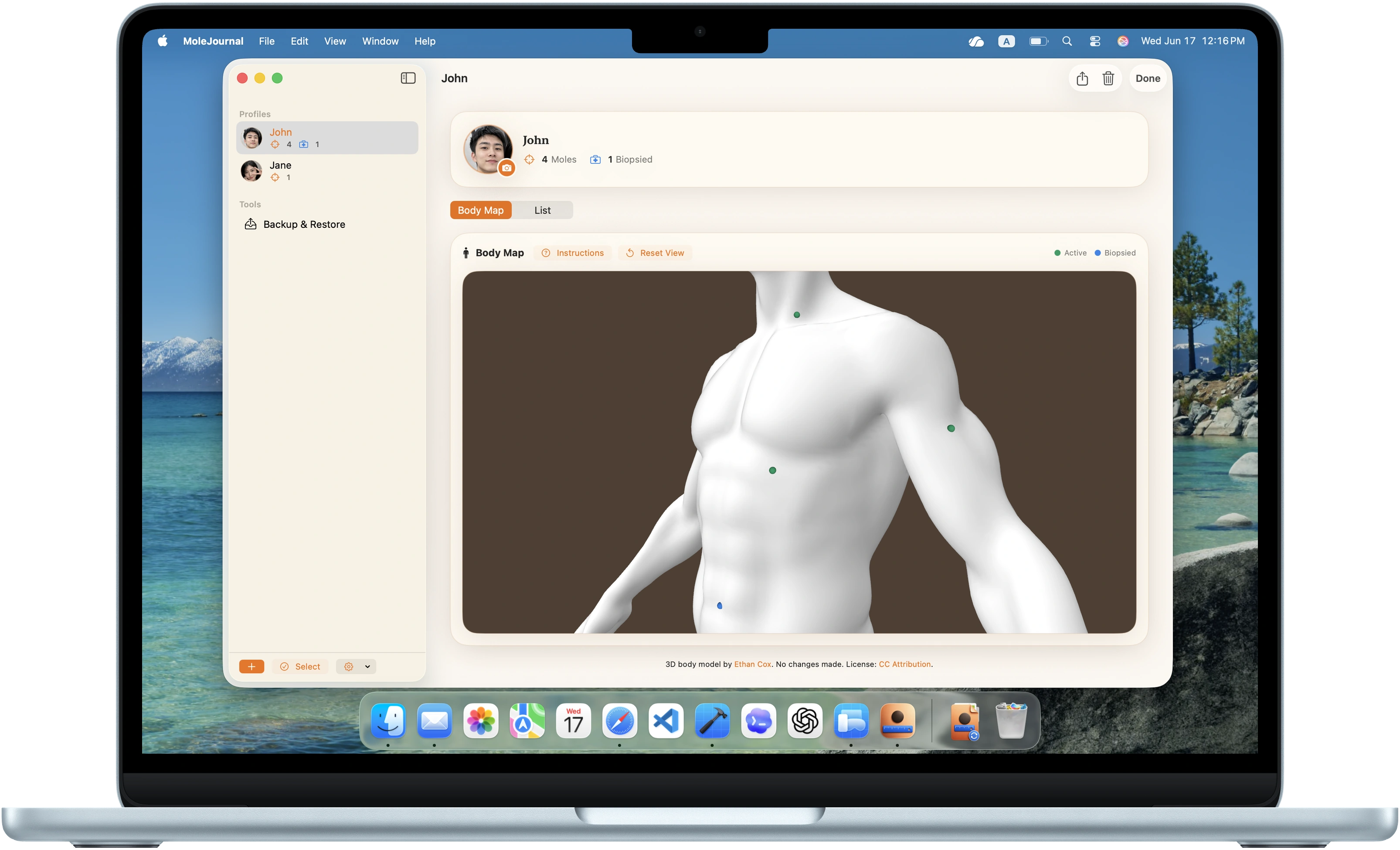 MoleJournal 3D body map on Mac