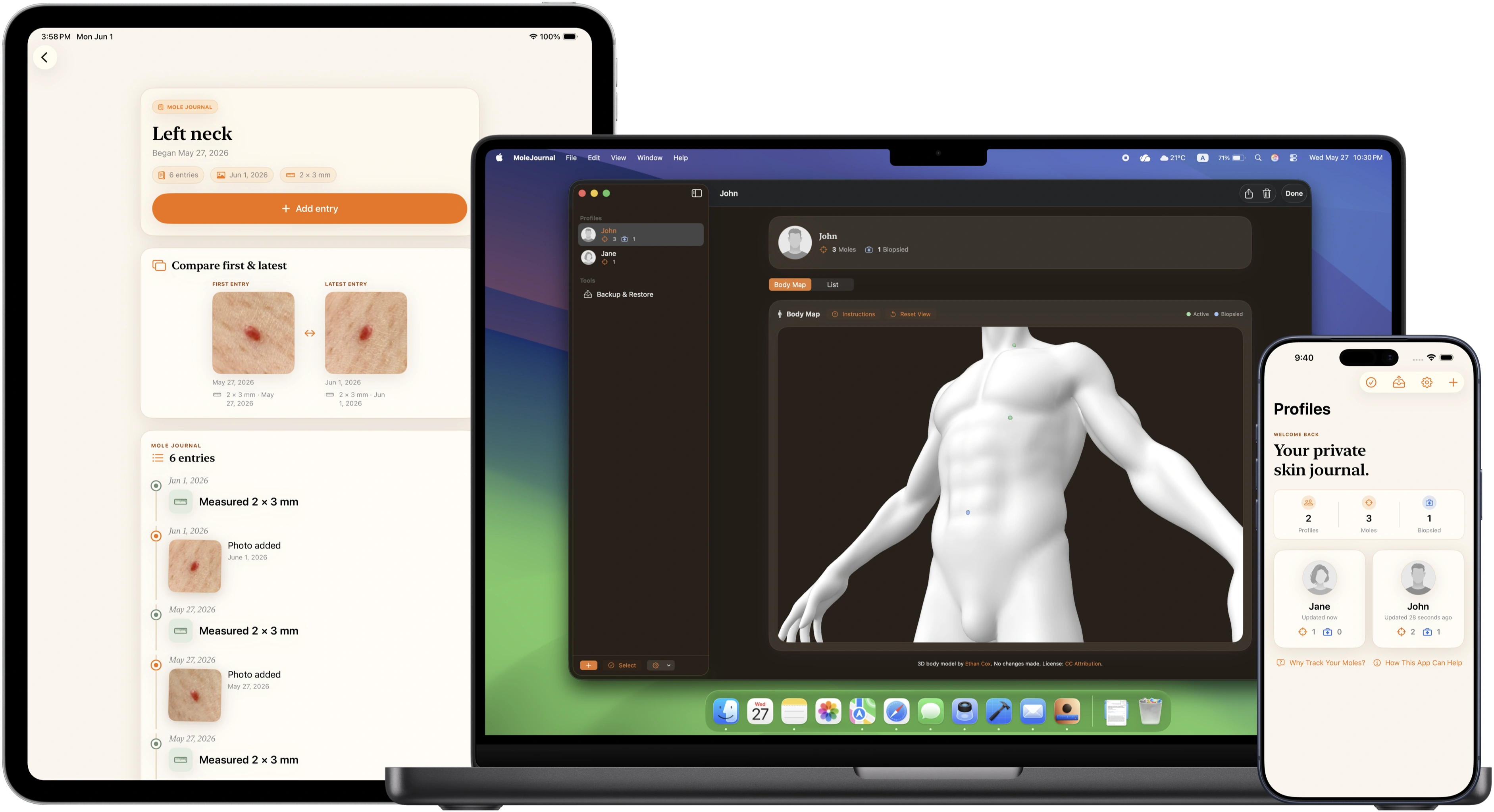 MoleJournal screenshots stacked on MacBook Pro, iPad Pro, and iPhone